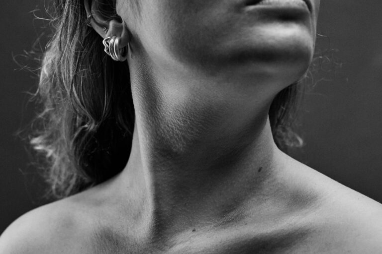 Han sagde, du overdriver skat. Ny kampagne om kvælningsvold